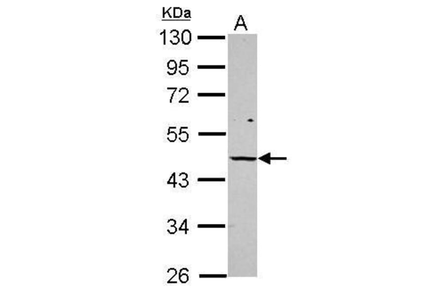 Vitamin D Receptor Antibody from Signalway Antibody (35519) - Antibodies.com