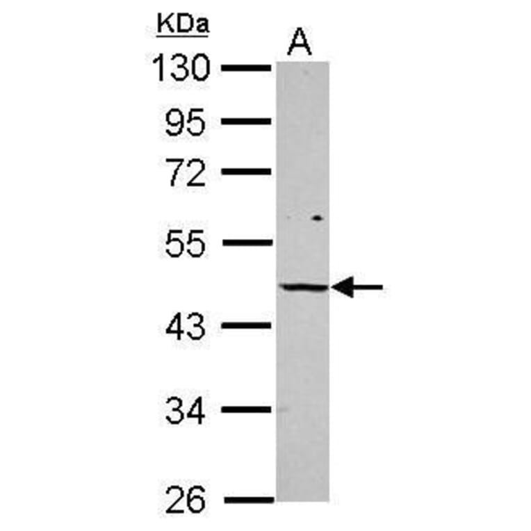 Vitamin D Receptor Antibody from Signalway Antibody (35519) - Antibodies.com