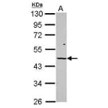 Vitamin D Receptor Antibody from Signalway Antibody (35519) - Antibodies.com