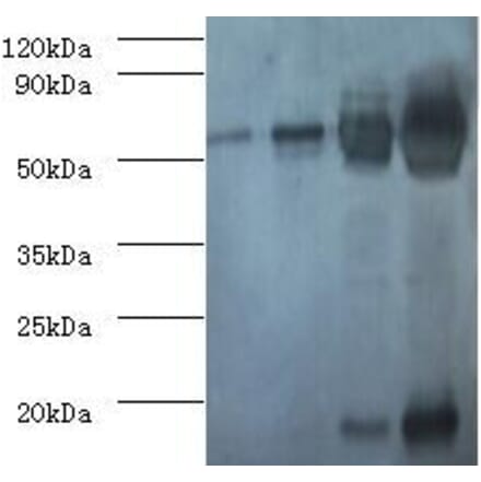 RuBisCO Polyclonal Antibody from Signalway Antibody (42065) - Antibodies.com