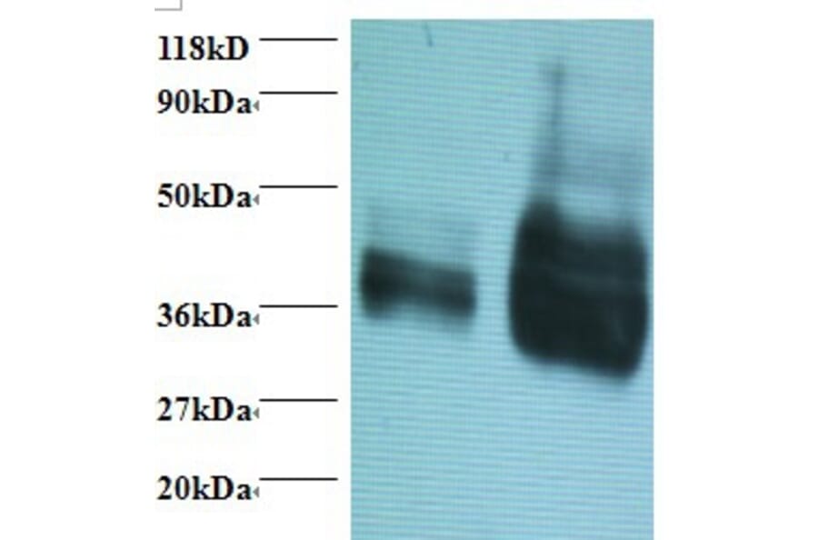 Gliadin Polyclonal Antibody from Signalway Antibody (42101) - Antibodies.com
