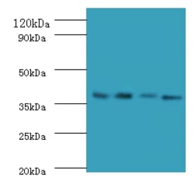 Western blot - IgG receptor FcRn large subunit p51 Polyclonal Antibody from Signalway Antibody - Antibodies.com