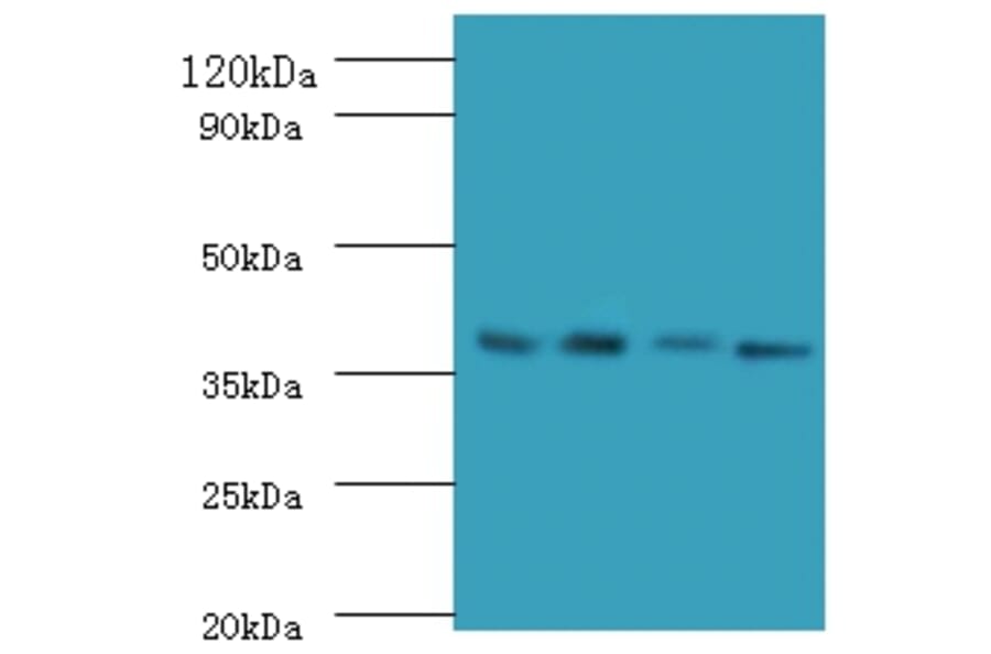 Western blot - IgG receptor FcRn large subunit p51 Polyclonal Antibody from Signalway Antibody - Antibodies.com