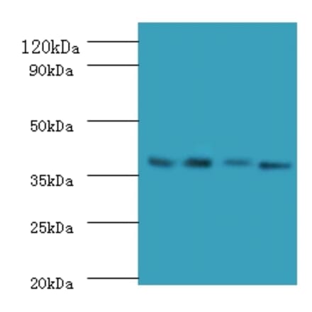 Western blot - IgG receptor FcRn large subunit p51 Polyclonal Antibody from Signalway Antibody - Antibodies.com
