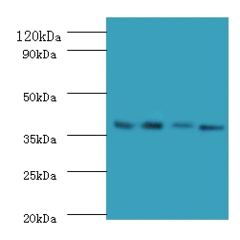 Western blot - IgG receptor FcRn large subunit p51 Polyclonal Antibody from Signalway Antibody - Antibodies.com