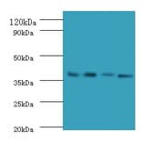 Western blot - IgG receptor FcRn large subunit p51 Polyclonal Antibody from Signalway Antibody - Antibodies.com