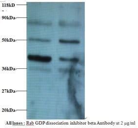 Rab GDP dissociation inhibitor beta Polyclonal Antibody from Signalway Antibody (42182) - Antibodies.com