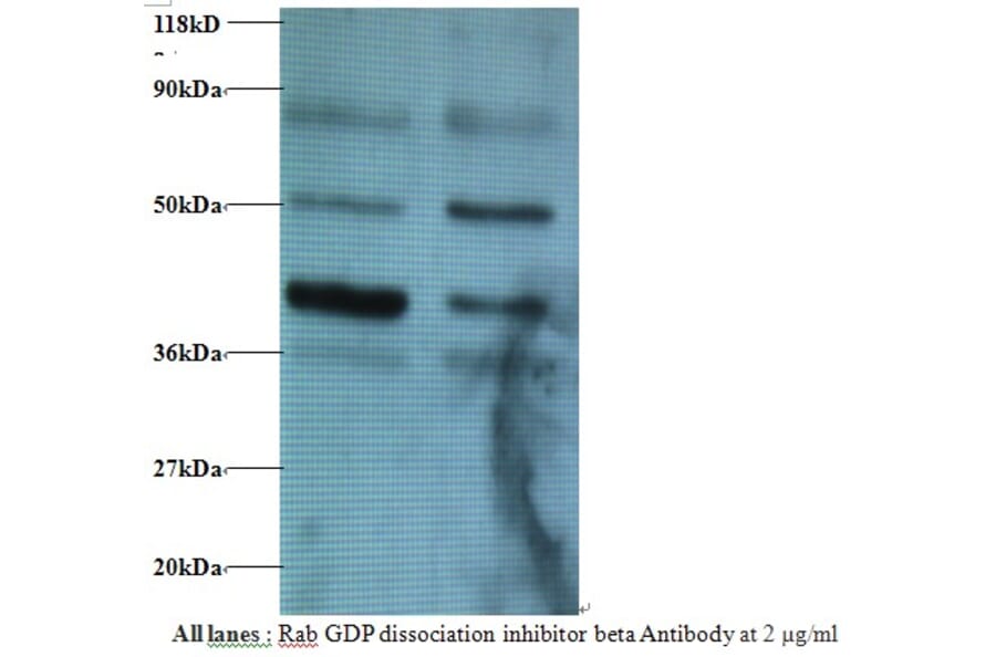 Rab GDP dissociation inhibitor beta Polyclonal Antibody from Signalway Antibody (42182) - Antibodies.com