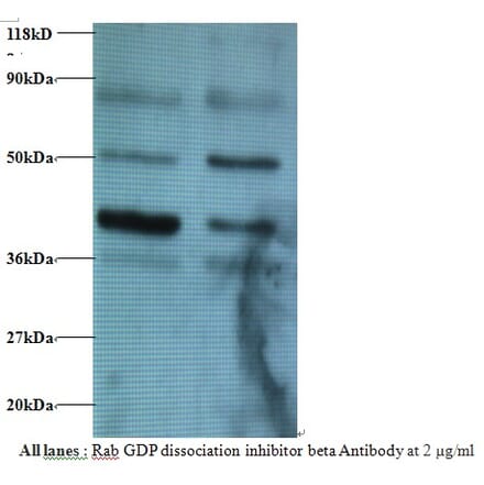 Rab GDP dissociation inhibitor beta Polyclonal Antibody from Signalway Antibody (42182) - Antibodies.com