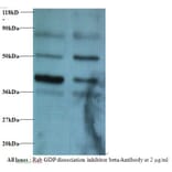 Rab GDP dissociation inhibitor beta Polyclonal Antibody from Signalway Antibody (42182) - Antibodies.com