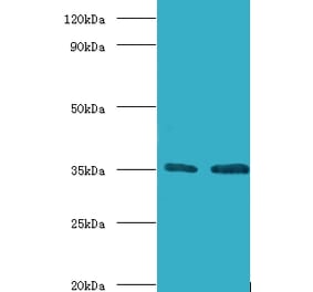 Transcription initiation factor IIB Polyclonal Antibody from Signalway Antibody (42193) - Antibodies.com