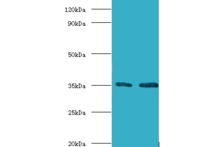 Transcription initiation factor IIB Polyclonal Antibody from Signalway Antibody (42193) - Antibodies.com