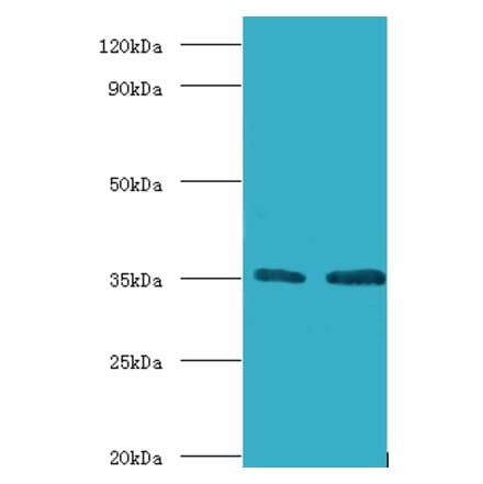 Transcription initiation factor IIB Polyclonal Antibody from Signalway Antibody (42193) - Antibodies.com