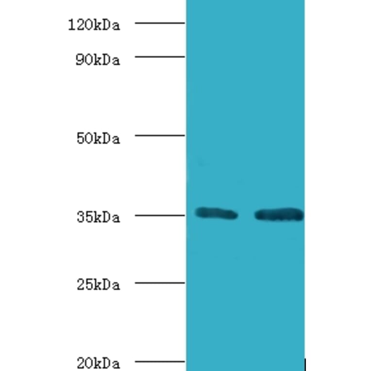 Transcription initiation factor IIB Polyclonal Antibody from Signalway Antibody (42193) - Antibodies.com