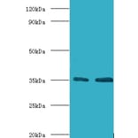 Transcription initiation factor IIB Polyclonal Antibody from Signalway Antibody (42193) - Antibodies.com