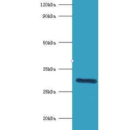 Indolethylamine N-methyltransferase Polyclonal Antibody from Signalway Antibody (42224) - Antibodies.com