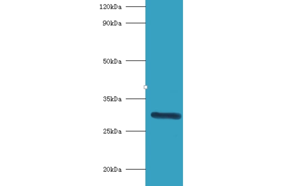 Indolethylamine N-methyltransferase Polyclonal Antibody from Signalway Antibody (42224) - Antibodies.com