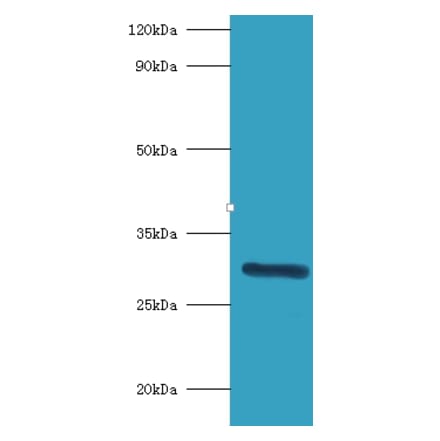 Indolethylamine N-methyltransferase Polyclonal Antibody from Signalway Antibody (42224) - Antibodies.com