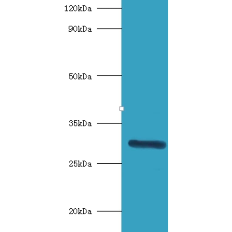 Indolethylamine N-methyltransferase Polyclonal Antibody from Signalway Antibody (42224) - Antibodies.com