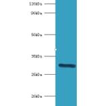 Indolethylamine N-methyltransferase Polyclonal Antibody from Signalway Antibody (42224) - Antibodies.com