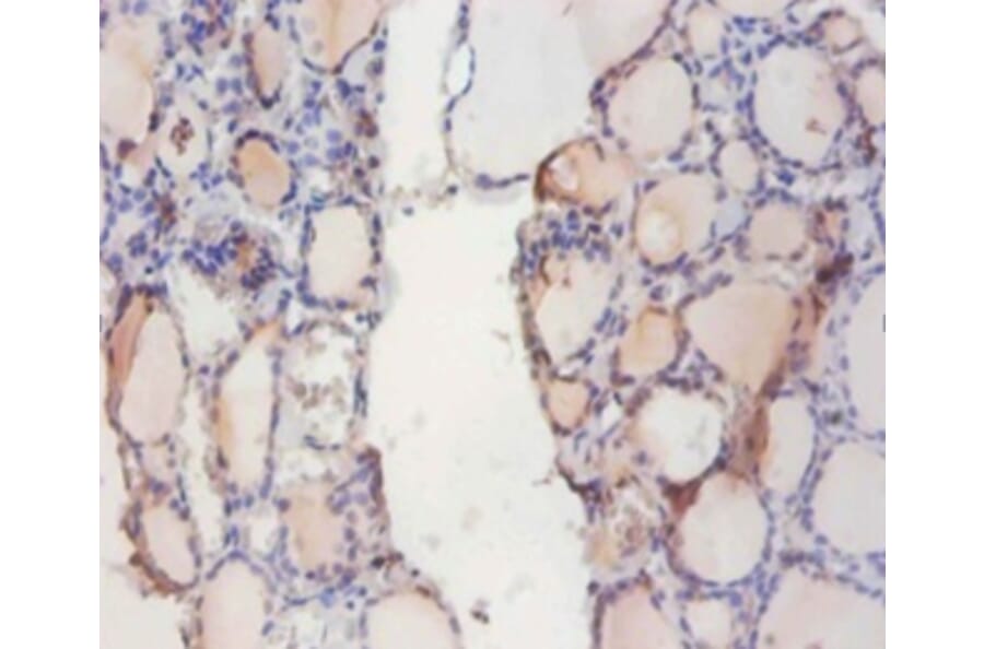 Immunohistochemistry - Indolethylamine N-methyltransferase Polyclonal Antibody from Signalway Antibody (42224)