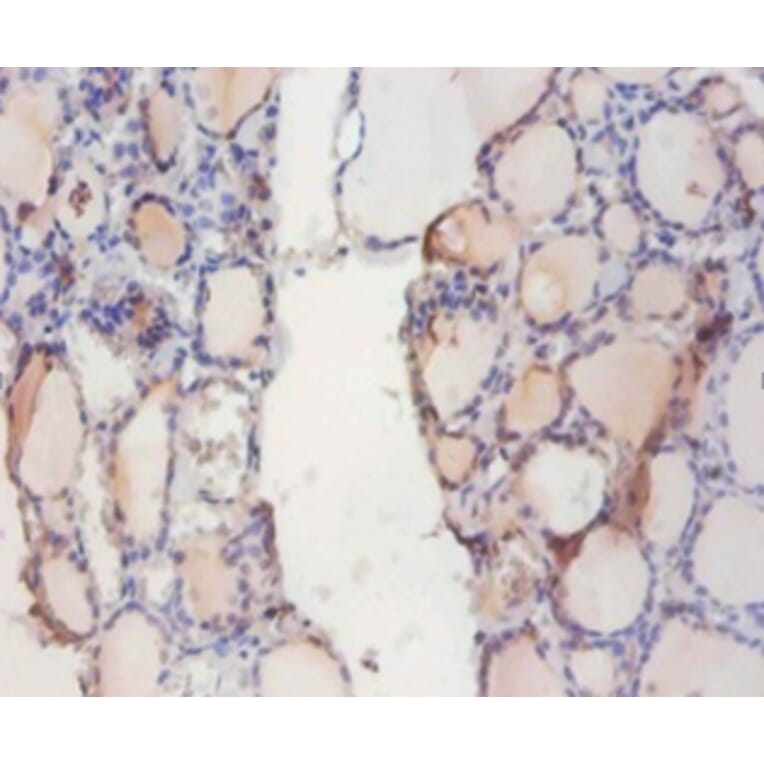 Immunohistochemistry - Indolethylamine N-methyltransferase Polyclonal Antibody from Signalway Antibody (42224)