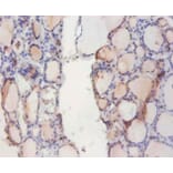 Immunohistochemistry - Indolethylamine N-methyltransferase Polyclonal Antibody from Signalway Antibody (42224)