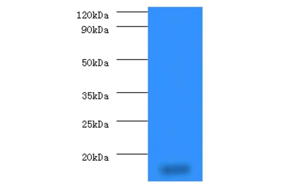 14 kDa phosphohistidine phosphatase Polyclonal Antibody from Signalway Antibody (42291) - Antibodies.com