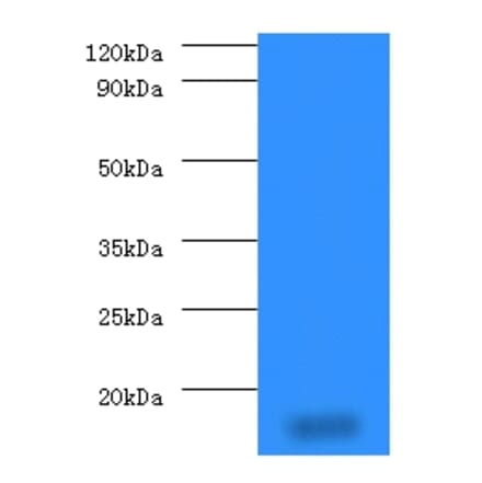 14 kDa phosphohistidine phosphatase Polyclonal Antibody from Signalway Antibody (42291) - Antibodies.com