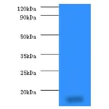 14 kDa phosphohistidine phosphatase Polyclonal Antibody from Signalway Antibody (42291) - Antibodies.com