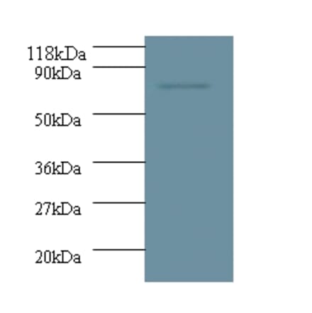 Deoxynucleoside triphosphate triphosphohydrolase SAMHD1 from Signalway Antibody (42317) - Antibodies.com