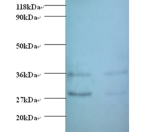 Protransforming growth factor alpha Polyclonal Antibody from Signalway Antibody (42480) - Antibodies.com