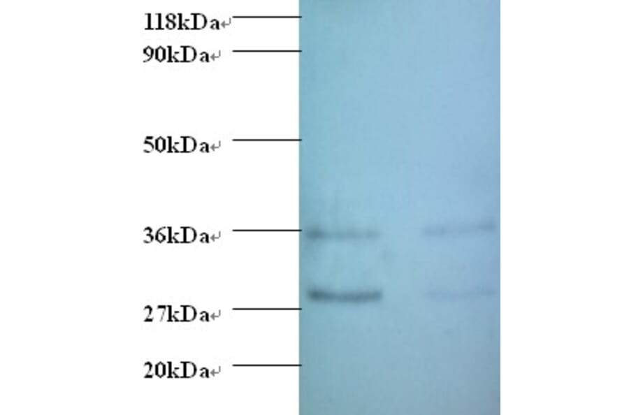 Protransforming growth factor alpha Polyclonal Antibody from Signalway Antibody (42480) - Antibodies.com