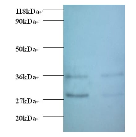 Protransforming growth factor alpha Polyclonal Antibody from Signalway Antibody (42480) - Antibodies.com