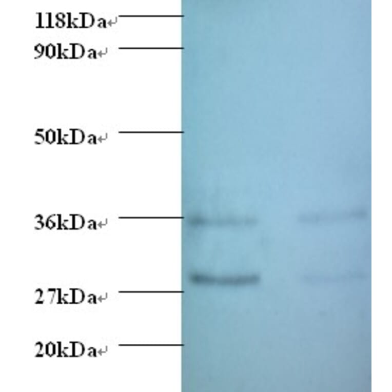Protransforming growth factor alpha Polyclonal Antibody from Signalway Antibody (42480) - Antibodies.com