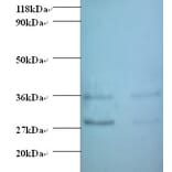 Protransforming growth factor alpha Polyclonal Antibody from Signalway Antibody (42480) - Antibodies.com