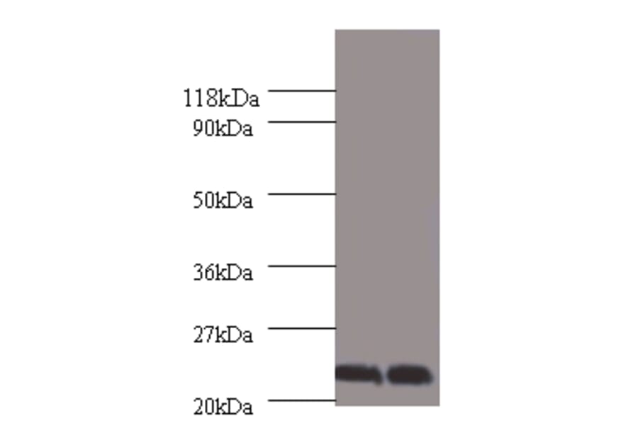 Chorionic somatomammotropin hormone Polyclonal Antibody from Signalway Antibody (42537) - Antibodies.com