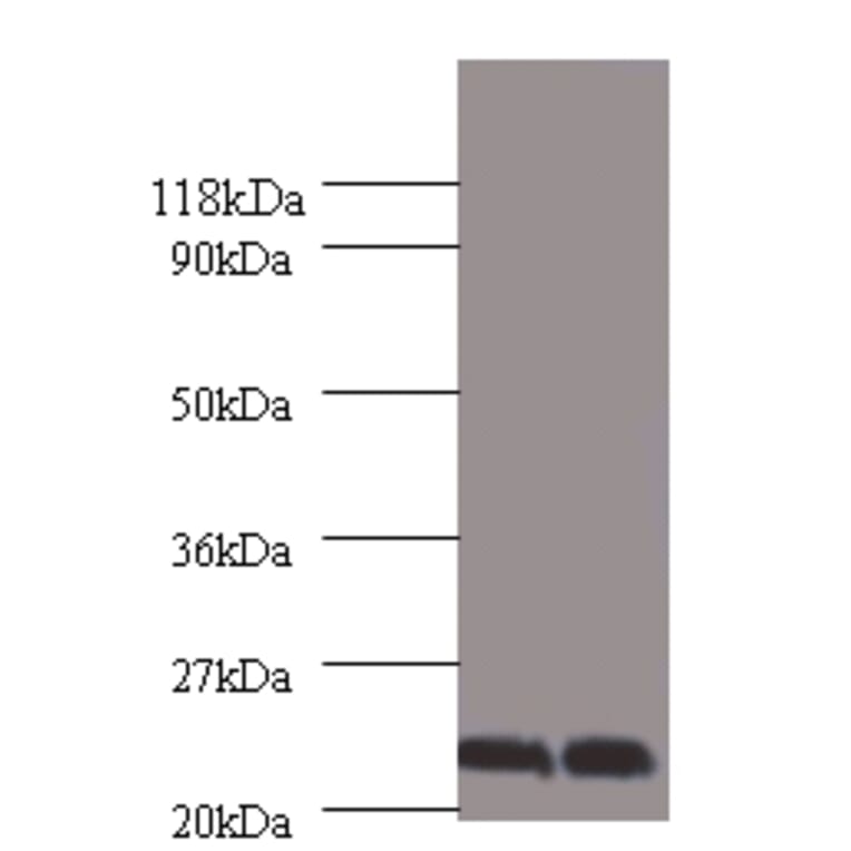 Chorionic somatomammotropin hormone Polyclonal Antibody from Signalway Antibody (42537) - Antibodies.com