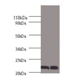 Chorionic somatomammotropin hormone Polyclonal Antibody from Signalway Antibody (42537) - Antibodies.com