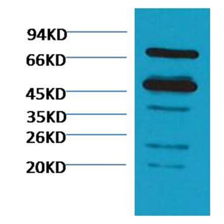 Western blot - Rubisco Mouse Polyclonal Antibody (Large Chain) from Signalway Antibody (38084) - Antibodies.com