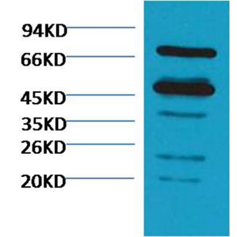 Western blot - Rubisco Mouse Polyclonal Antibody (Large Chain) from Signalway Antibody (38084) - Antibodies.com