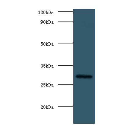Fibroblast growth factor 23 Polyclonal Antibody from Signalway Antibody (42170) - Antibodies.com