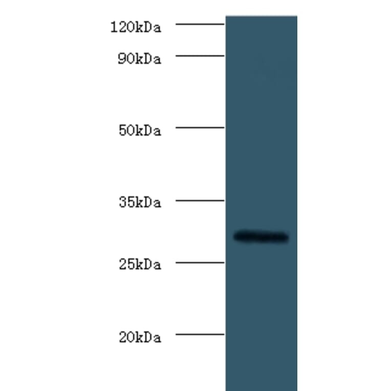 Fibroblast growth factor 23 Polyclonal Antibody from Signalway Antibody (42170) - Antibodies.com