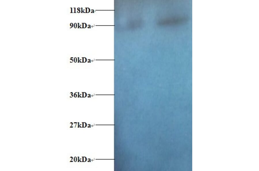 Diamine acetyltransferase 1 Polyclonal Antibody from Signalway Antibody (42374) - Antibodies.com