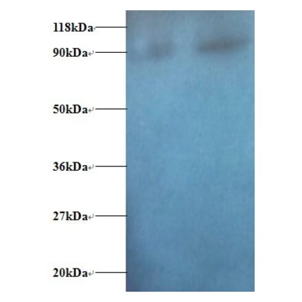 Diamine acetyltransferase 1 Polyclonal Antibody from Signalway Antibody (42374) - Antibodies.com