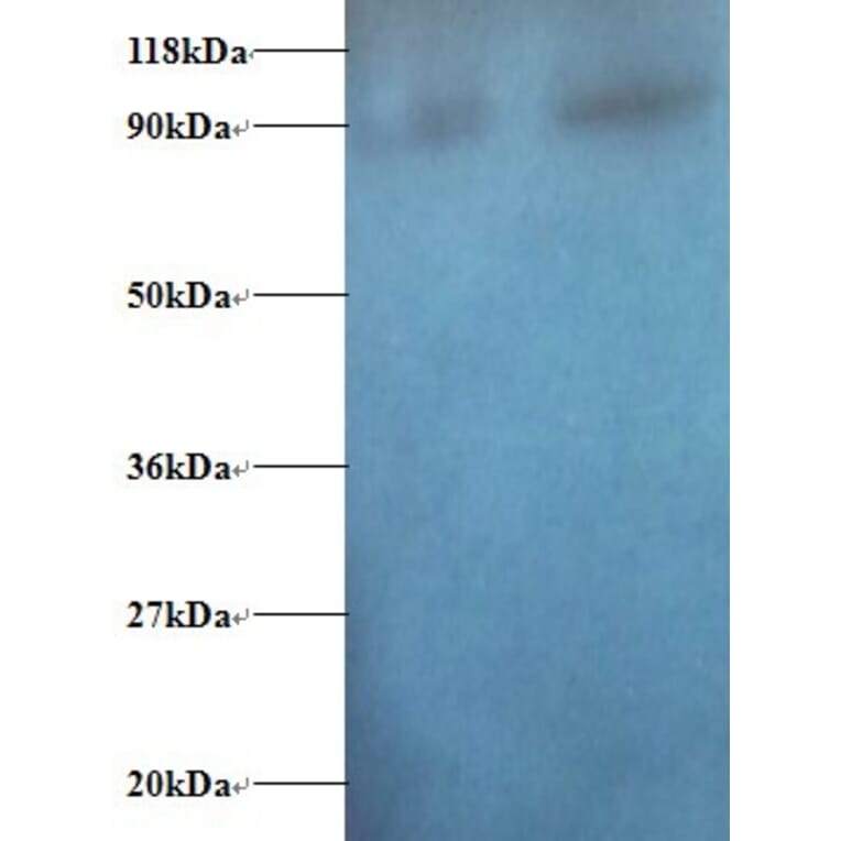 Diamine acetyltransferase 1 Polyclonal Antibody from Signalway Antibody (42374) - Antibodies.com