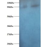 Diamine acetyltransferase 1 Polyclonal Antibody from Signalway Antibody (42374) - Antibodies.com