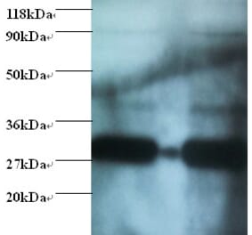 Glutathione S-transferase P Polyclonal Antibody from Signalway Antibody (42521) - Antibodies.com