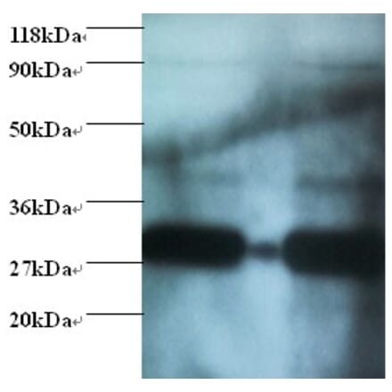 Glutathione S-transferase P Polyclonal Antibody from Signalway Antibody (42521) - Antibodies.com