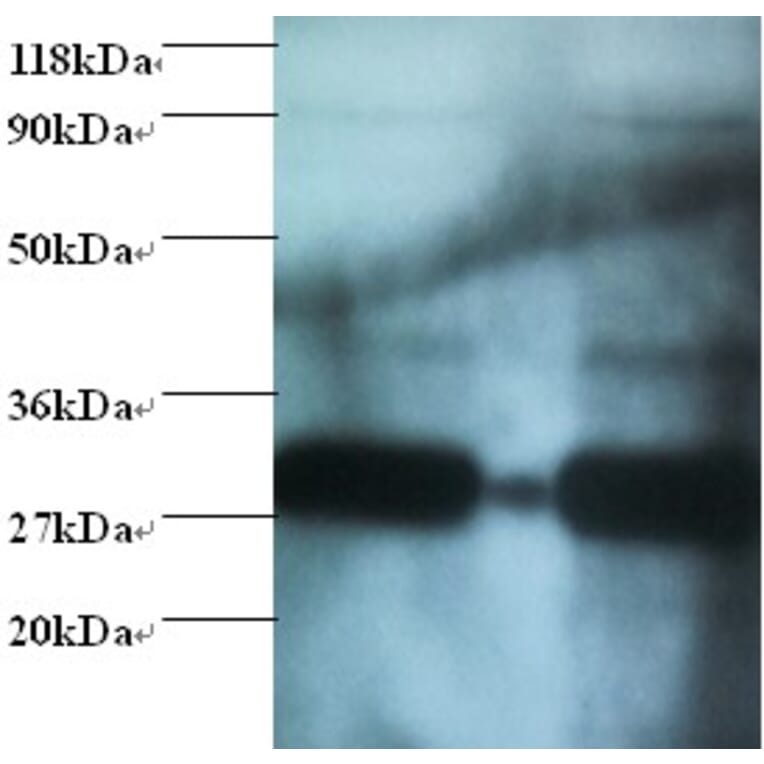 Glutathione S-transferase P Polyclonal Antibody from Signalway Antibody (42521) - Antibodies.com